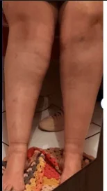 dor2