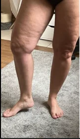 dor3