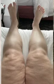 dor4